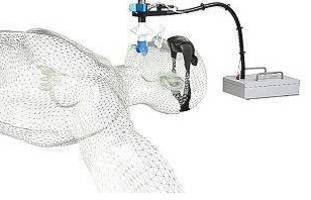 
LDRA Tool Suite Selected by Esprit Lean to Prove IEC 62304 Medical Compliance
