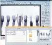 X-Ray Inspection Modules automate failure analysis.