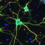 Image Analysis Software aids neurobiology research.