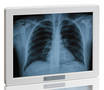 Atom CPU-based Touch Panel PC suits medical equipment OEMs.