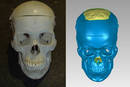 
NVision Helps Orthodontic Company Recalibrate CT Scanner
