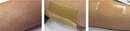 Thin Absorbent Skin Adhesive is suited for medical applications.