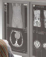 Image Processing System dicomPACS® Convinced in Oldest Radiology Center of Hambug; RÃ¶ntgeninstitut Schlopgarten
