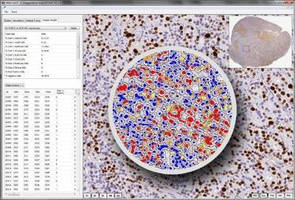 Philips and Indica Labs Team to Accelerate Cancer Research through Advanced Image Analysis