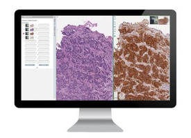 Leica Biosystems Introduces Multiple Aperio Digital Pathology Products and Product Enhancements*