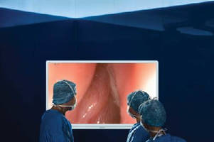 Imaging System optimizes visualization during ENT procedures.