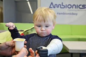 Ambionics Achieves Breakthrough Development of Unique Child Prosthetic With Stratasys 3D Printing