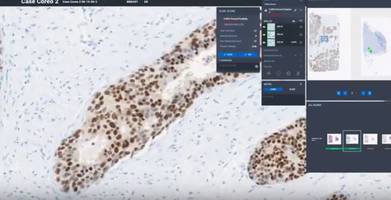 Roche Offers uPath Enterprise Software with Leeds Virtual Microscope Technology