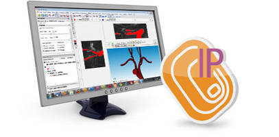 New Simpleware ScanIP Medical Enables Conversion of 3D Scan Data into High-quality Computer Models