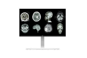 Latest Monitors from LG are Ideal for Hospitals and Clinics