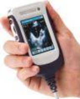 Portable Ultrasound Device has handheld form factor.