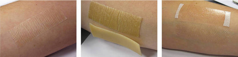 Thin Absorbent Skin Adhesive is suited for medical applications.