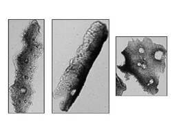 Particle Analyzers image encapsulated Paclitaxel.