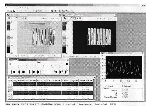 Thermal Imaging System has accuracy to 2 degrees C.